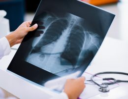 radiografia-toracica-centro-medico-radiologico-borgomanero
